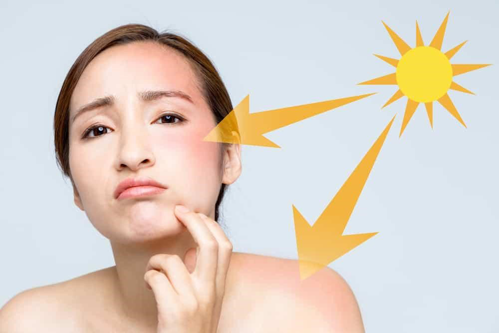 V&igrave; sao phụ nữ Việt lại dễ bị n&aacute;m? - Ảnh 2.