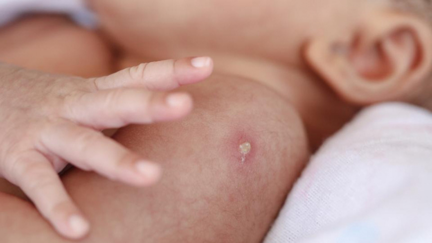 800 nh&acirc;n vi&ecirc;n y tế tuyến đầu sẽ ti&ecirc;m thử nghiệm vaccine ngừa lao v&agrave; bệnh Covid-19 - Ảnh 2.
