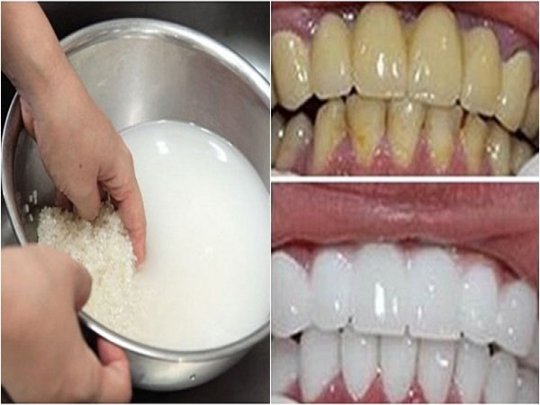 Bí quyết từ thiên nhiên để có hàm răng trắng sáng ngay tại nhà - Ảnh 2.