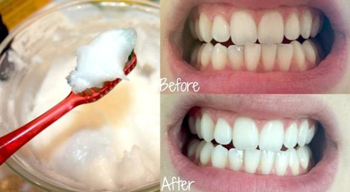 Bí quyết từ thiên nhiên để có hàm răng trắng sáng ngay tại nhà - Ảnh 5.