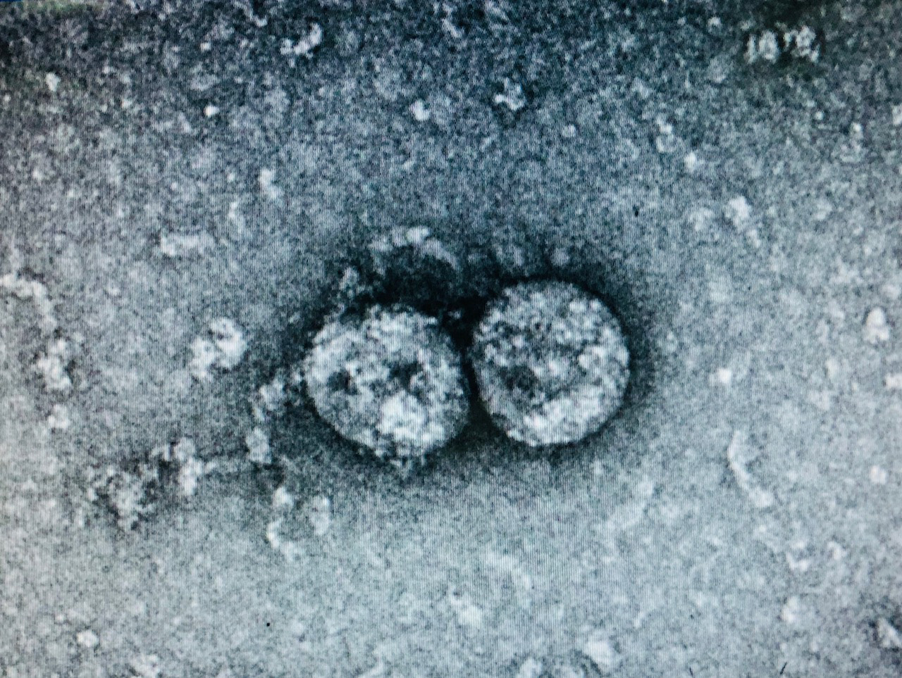 Phát hiện chủng virus SARS-CoV-2 gây dịch Covid-19 tại VN có thay đổi