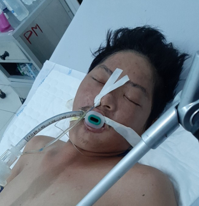 Tìm thân nhân nam thanh niên bị hôn mê sâu ở Phú Quốc - Ảnh 1.