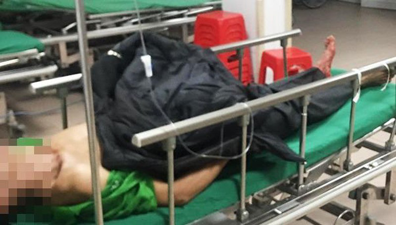Tự đâm vào bụng, người đàn ông tới bệnh viện cấp cứu cùng đoạn ruột đứt rời