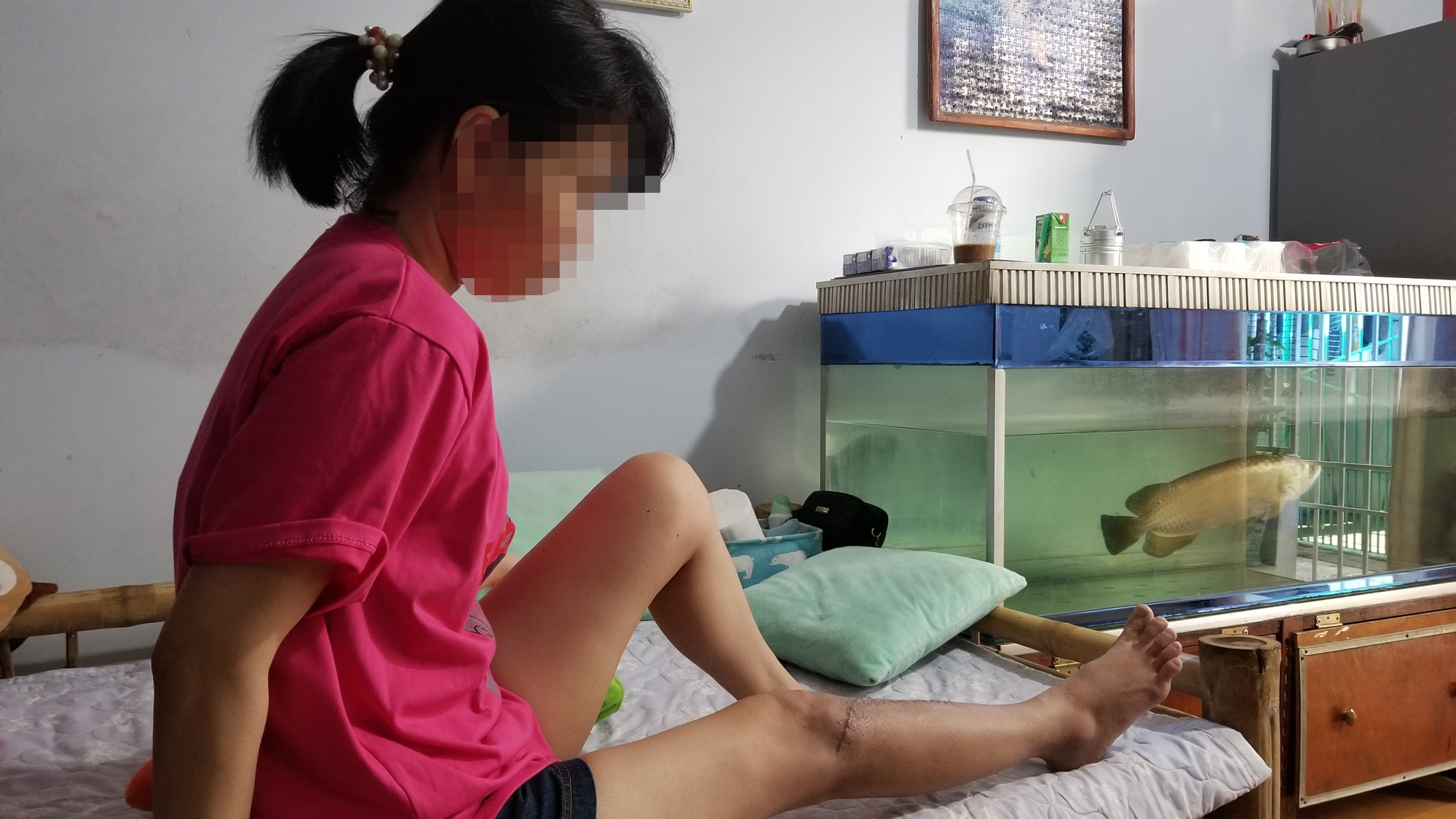Đà Nẵng: Điều tra vụ kế toán trưởng bị nam quản lý đánh gãy chân
