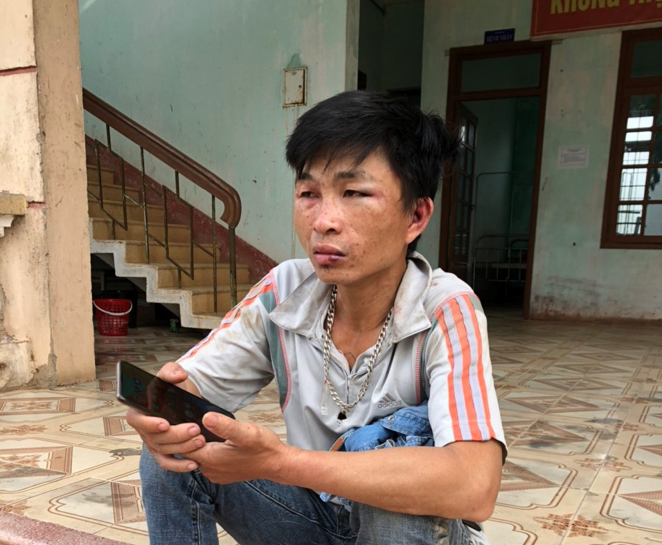 Đi trộm ch&oacute; bị ph&aacute;t gi&aacute;c, cẩu tặc d&ugrave;ng dao ch&eacute;m người d&acirc;n trọng thương - Ảnh 1.