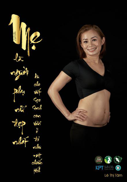 Vết sẹo tái sinh nhân loại trong bộ ảnh “Mẹ là người đẹp nhất” ra mắt nhân Ngày của mẹ - Ảnh 4.