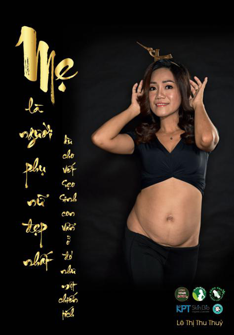 Vết sẹo tái sinh nhân loại trong bộ ảnh “Mẹ là người đẹp nhất” ra mắt nhân Ngày của mẹ - Ảnh 7.