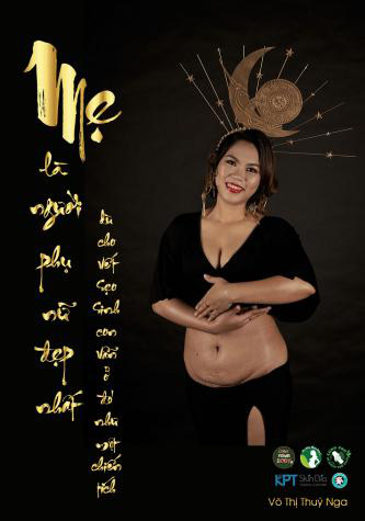 Vết sẹo tái sinh nhân loại trong bộ ảnh “Mẹ là người đẹp nhất” ra mắt nhân Ngày của mẹ - Ảnh 9.