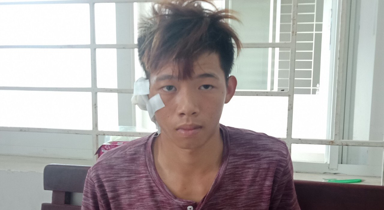 Đâm chết bạn ghe vì bực tức khi bị cắt tai