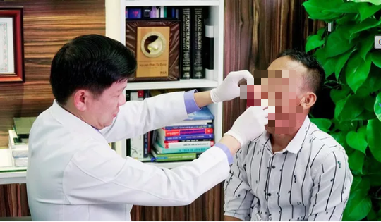 Gương mặt 1 người ở An Giang biến dạng đến khó tin