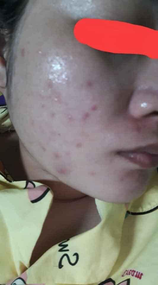 SỰ THẬT ĐÁNG SỢ TRONG “THẾ GIỚI KEM TRỘN”: Kinh hãi và ám ảnh!