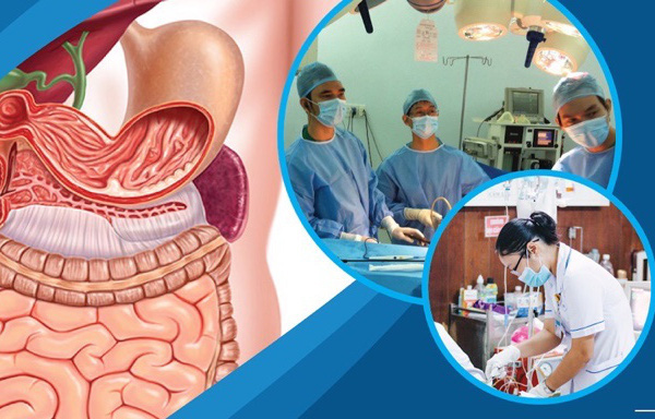 Khám, tư vấn miễn phí bệnh ung thư đường tiêu hóa