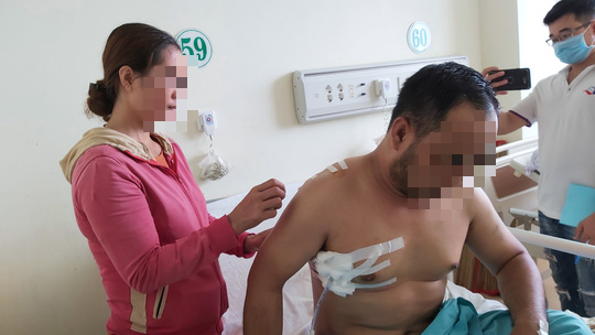 2 thanh niên vào nhà nghỉ, gõ cửa phòng và tấn công người đàn ông