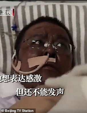 B&aacute;c sĩ Trung Quốc bị đổi m&agrave;u da v&igrave; Covid-19 qua đời sau gần 5 th&aacute;ng điều trị - Ảnh 2.