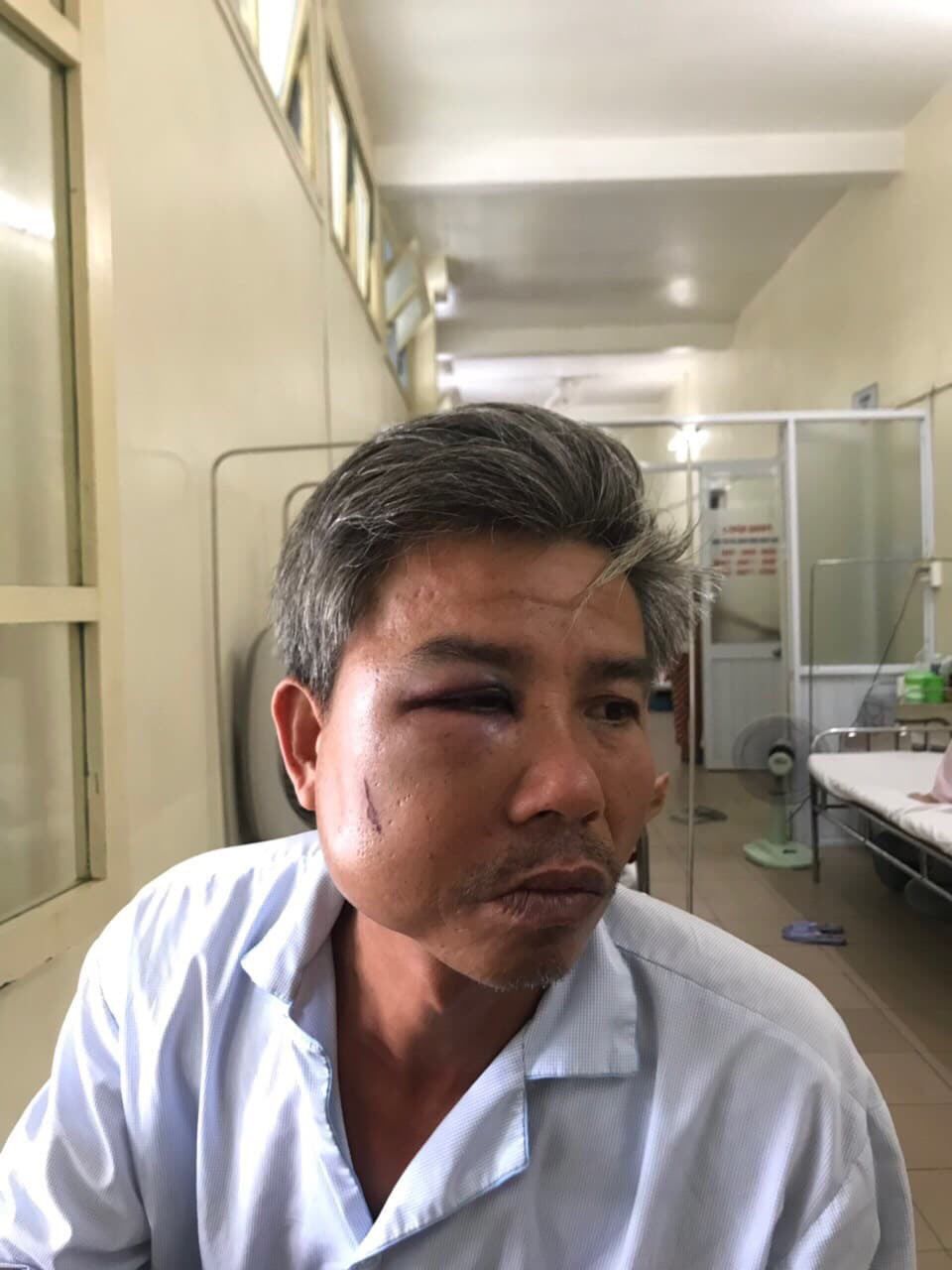 Chủ quán Bố Già ở Huế bị khởi tố