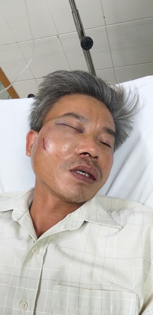 Nhân viên cây xanh bị đánh vì chụp hình băng rôn