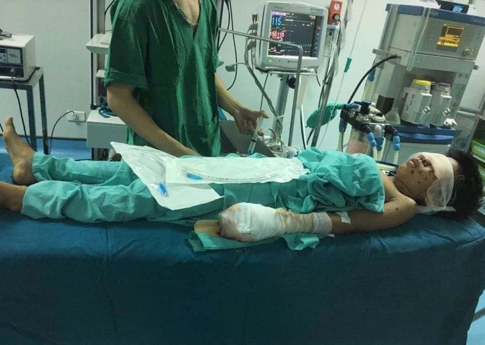 Thiếu niên bị nát tay, vỡ nhãn cầu cả 2 mắt sau tiếng nổ lớn