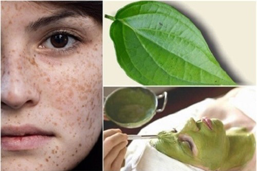 Mẹo trị nám tại nhà với lá trầu không, rẻ mà siêu hiệu quả