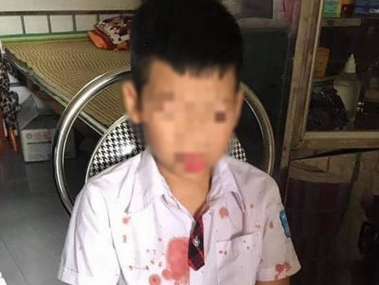 Con mâu thuẫn với bạn, bố tới trường lôi học sinh 7 tuổi ra ngoài hành hung