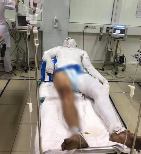 Chủ nợ chặn con nợ giữa đường đổ xăng l&ecirc;n người ch&acirc;m lửa đốt - Ảnh 2.