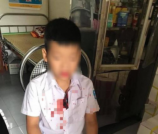 Khởi tố phụ huynh hành hung học sinh lớp 1 nhập viện
