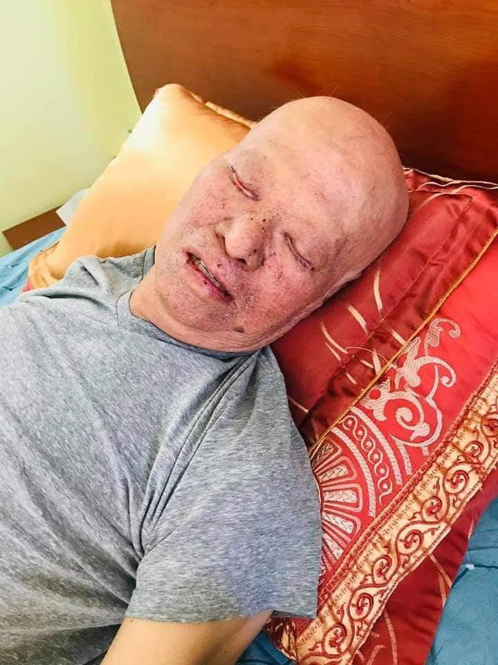 X&uacute;c động h&igrave;nh ảnh HLV L&ecirc; Thụy Hải chữa trị ung thư tụy - Ảnh 1.