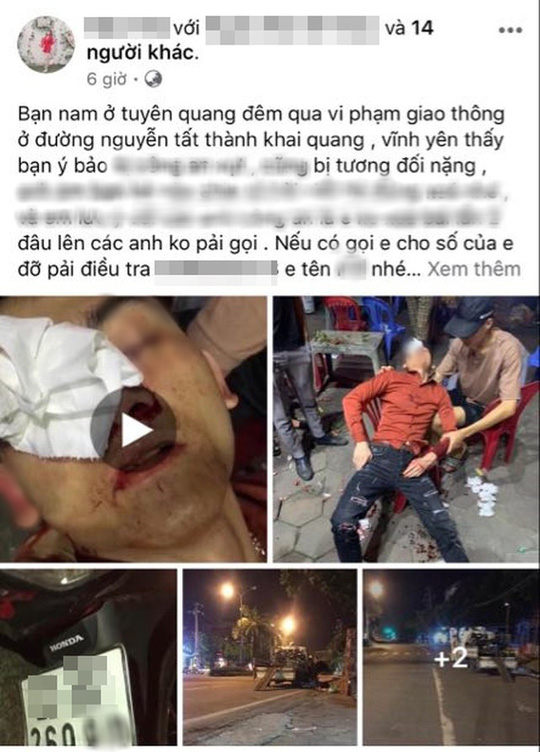 Gặp chốt CSGT, nam thanh ni&ecirc;n quay đầu bỏ chạy, bị g&atilde;y xương mũi - Ảnh 1.