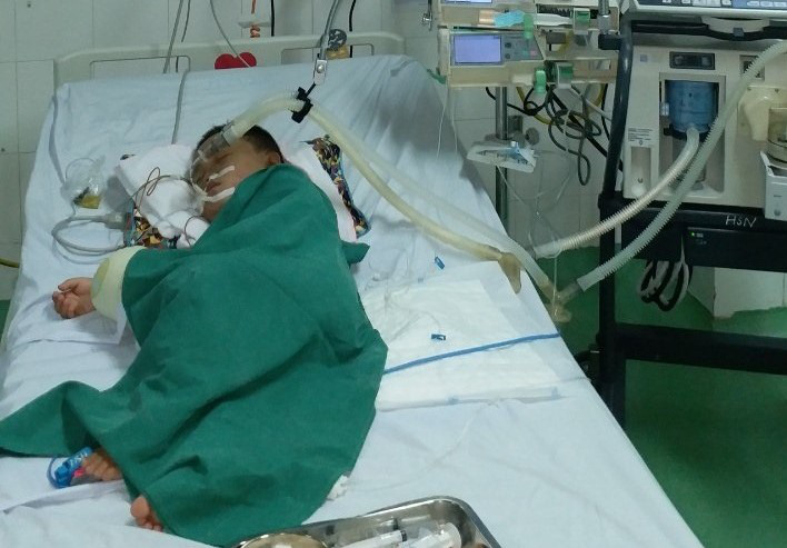 Chơi trong vườn nhà, bé trai bị ong vò vẽ đốt hơn 80 mũi