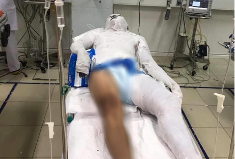 Vụ đổ xăng “thiêu sống” nam thanh niên giữa đường: Tạm giữ 1 nghi can
