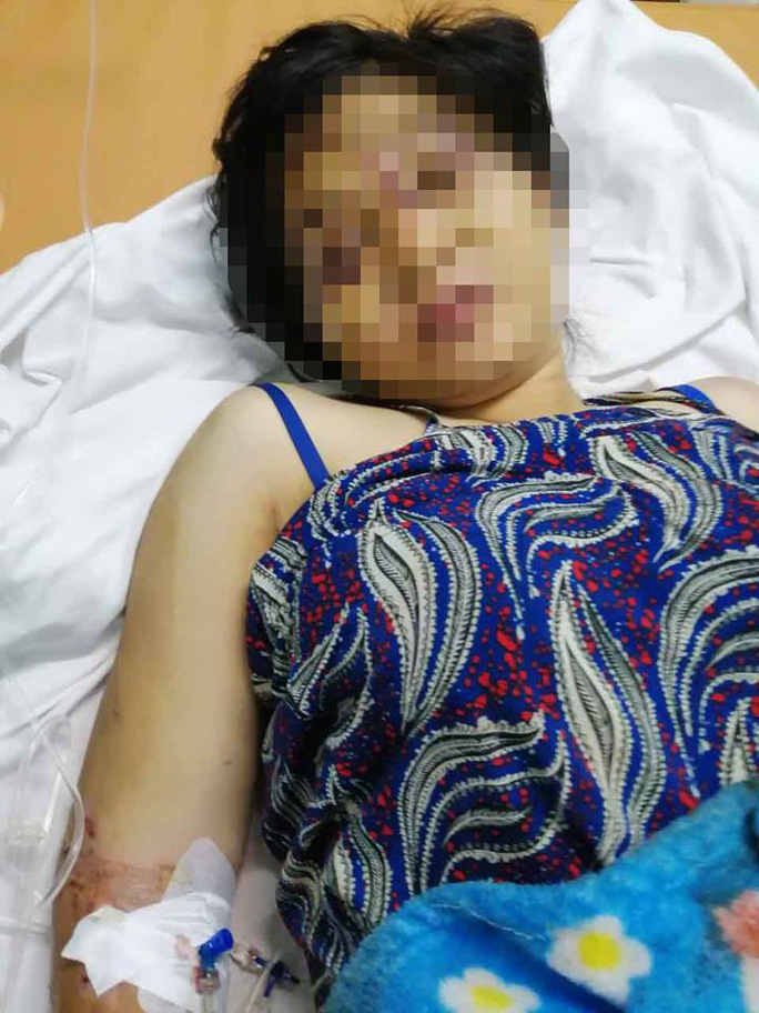 C&ocirc; g&aacute;i ở B&igrave;nh Ch&aacute;nh bị h&agrave;nh hạ đến sảy thai - Ảnh 1.