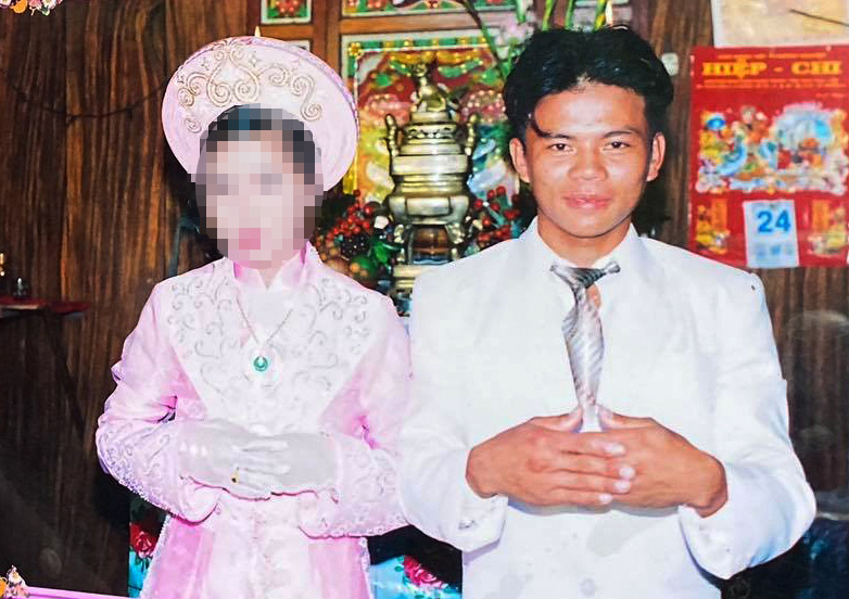 Khát khao của chàng trai mặt quỷ, 15 năm ngủ ngồi - Ảnh 2.