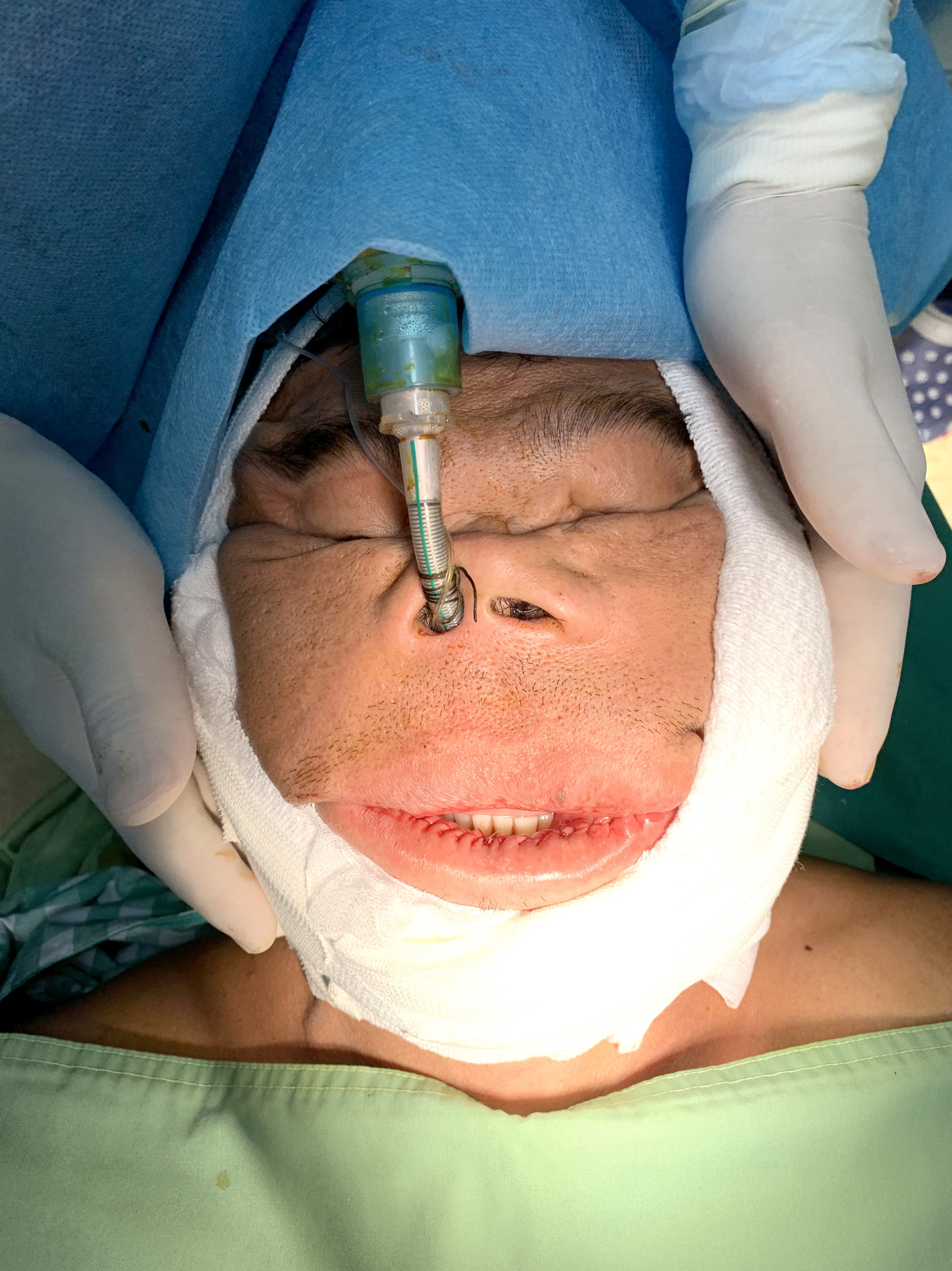 T&acirc;m sự của b&aacute;c sĩ sau ca đại phẫu ch&agrave;ng trai mặt quỷ - Ảnh 4.
