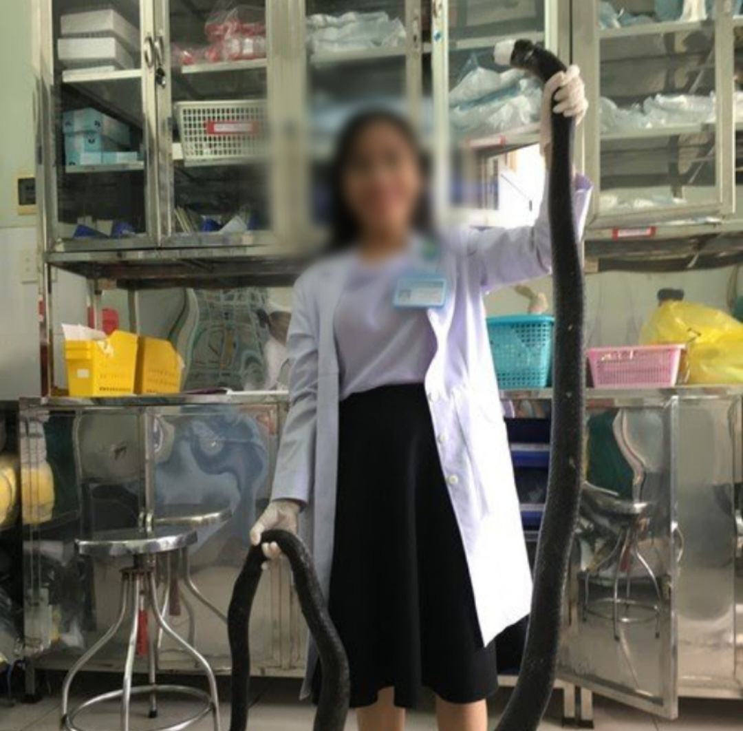 Bệnh nhân bị rắn hổ mang chúa cắn tình trạng vẫn rất nặng