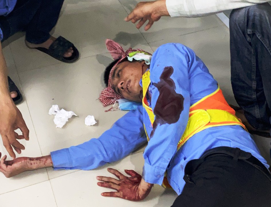 Khánh Hòa: Nhân viên Trạm thu phí BOT Ninh Xuân bị đánh trọng thương