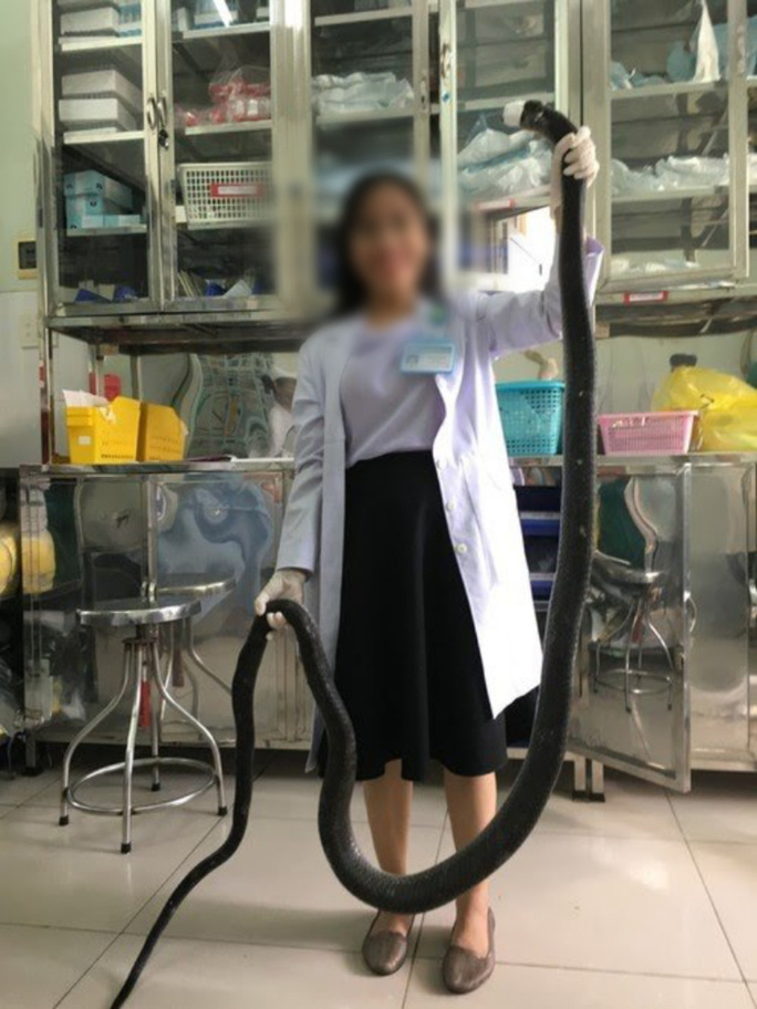 CLIP: T&agrave;i xế kể chuyện chở người bị rắn hổ mang ch&uacute;a cắn ở n&uacute;i B&agrave; Đen đi cấp cứu - Ảnh 3.