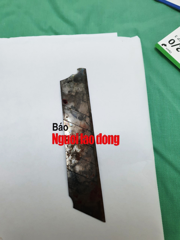 CLIP: Cứu người đ&agrave;n &ocirc;ng bị m&aacute;y cắt cỏ ch&eacute;m thủng bụng, l&ograve;i ruột ra ngo&agrave;i - Ảnh 2.