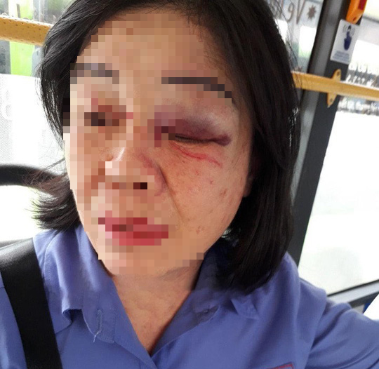 Công an truy tìm kẻ đánh nữ tiếp viên xe buýt 65 bầm mắt