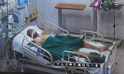 Một bệnh nhân Covid-19 nhiễm vi khuẩn đa kháng thuốc