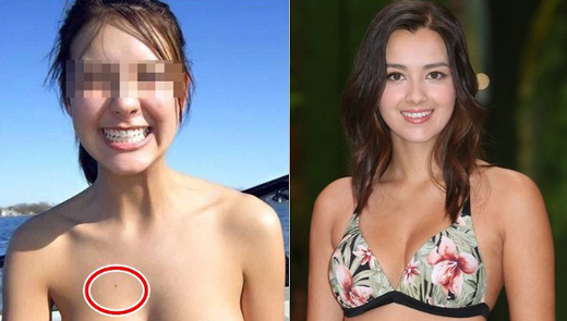 Hoa hậu Hồng Kông nghi lộ ảnh khỏa thân, dân mạng phân tích nốt ruồi trên ngực