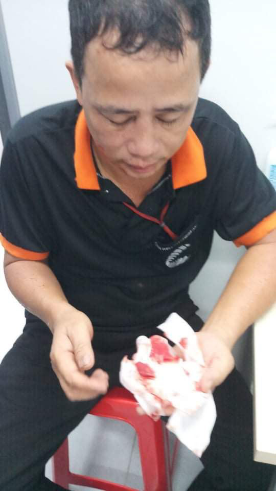 Phó giám đốc cùng nhân viên đánh hội đồng người dân ở Đồng Nai - Ảnh 4.