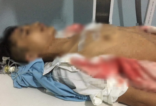 Nam sinh bị học sinh lớp trên đâm ngay tại cổng trường