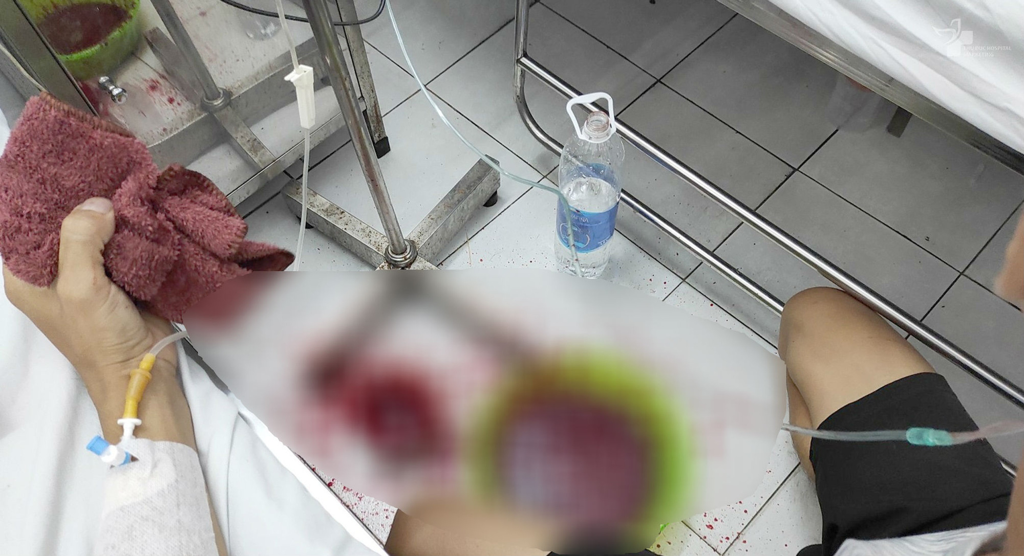 Đua thời gian với ca ộc máu dữ dội tại giường bệnh