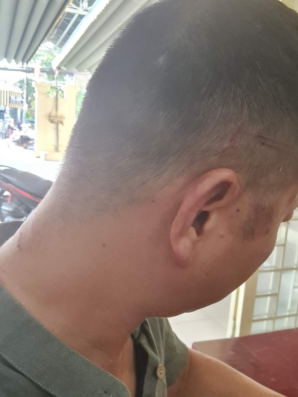 Nửa đêm xông vào nhà truy sát người - Ảnh 1.