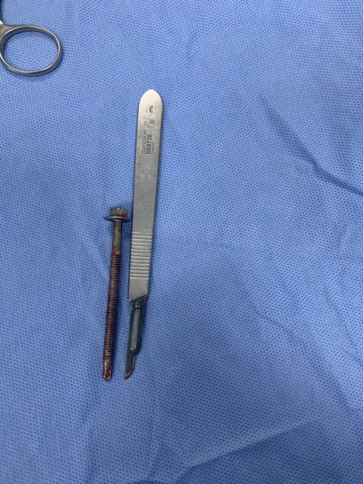 Người đ&agrave;n &ocirc;ng đến bệnh viện với chiếc ốc v&iacute;t d&agrave;i 6cm xo&aacute;y v&agrave;o giữa dương vật - Ảnh 1.