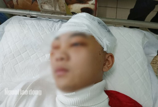 Khởi tố, bắt giam nam sinh lớp 11 đánh bạn học vỡ sọ não