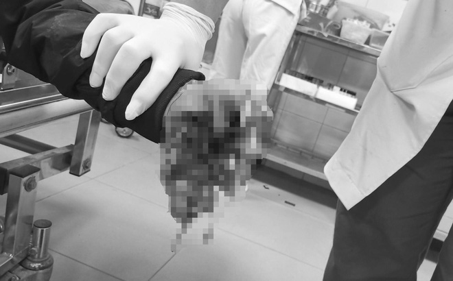Hai học sinh thương vong sau tiếng nổ lớn trong đêm