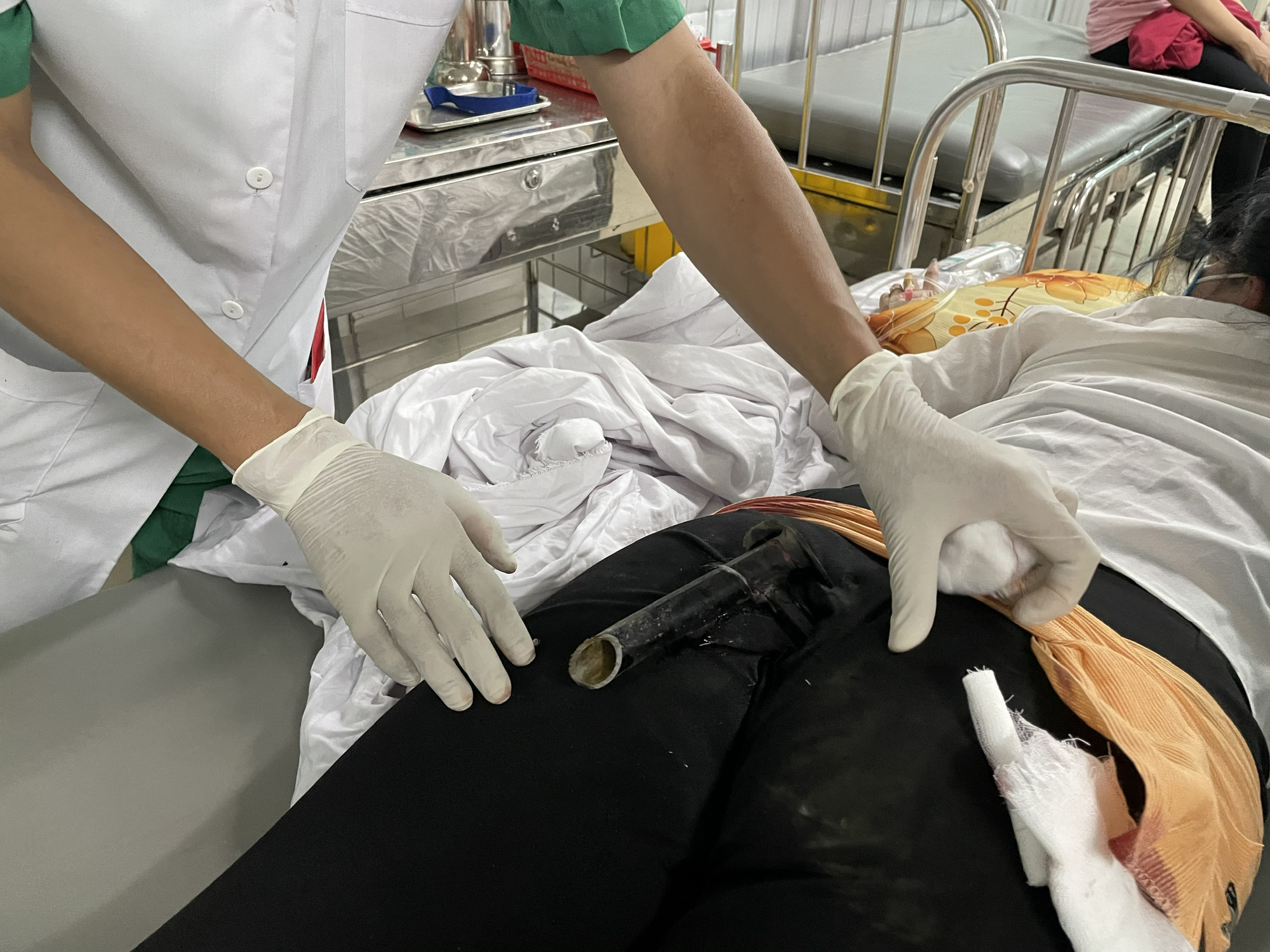 Va chạm giao thông, cô gái bị chân chống xe máy đâm thẳng vào mông
