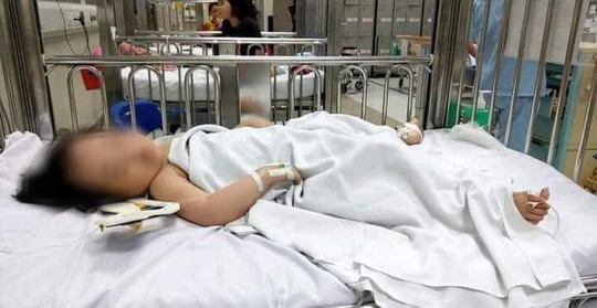 Th&ocirc;ng tin mới nhất về sức khoẻ b&eacute; g&aacute;i 3 tuổi rơi từ tầng 12A chung cư - Ảnh 1.