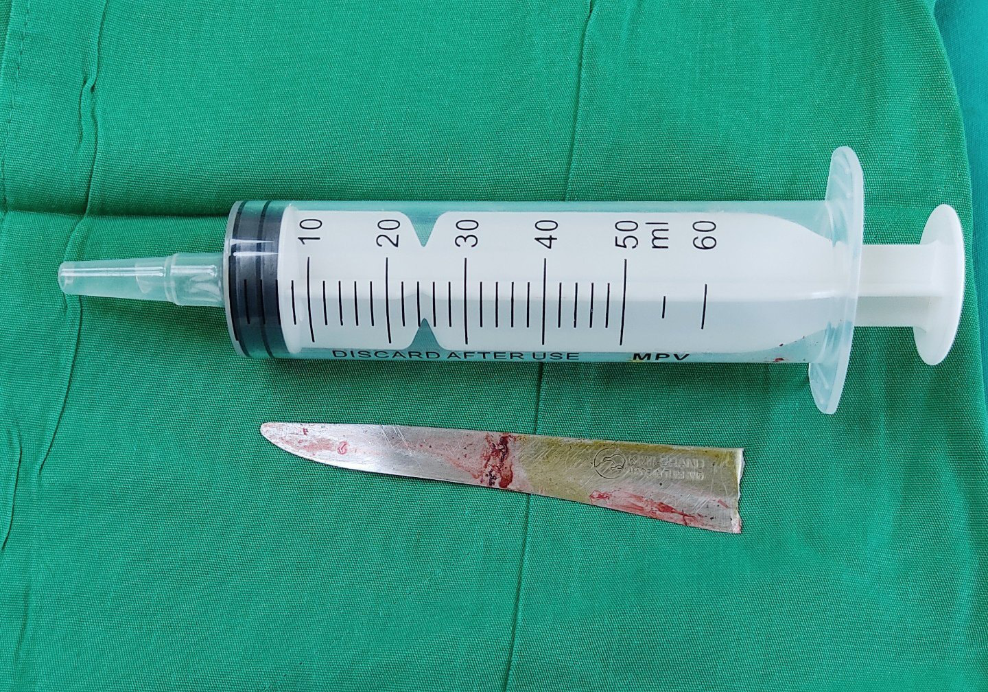 C&atilde;i v&atilde; với bạn g&aacute;i, thanh ni&ecirc;n tự đ&acirc;m thủng tim - Ảnh 2.