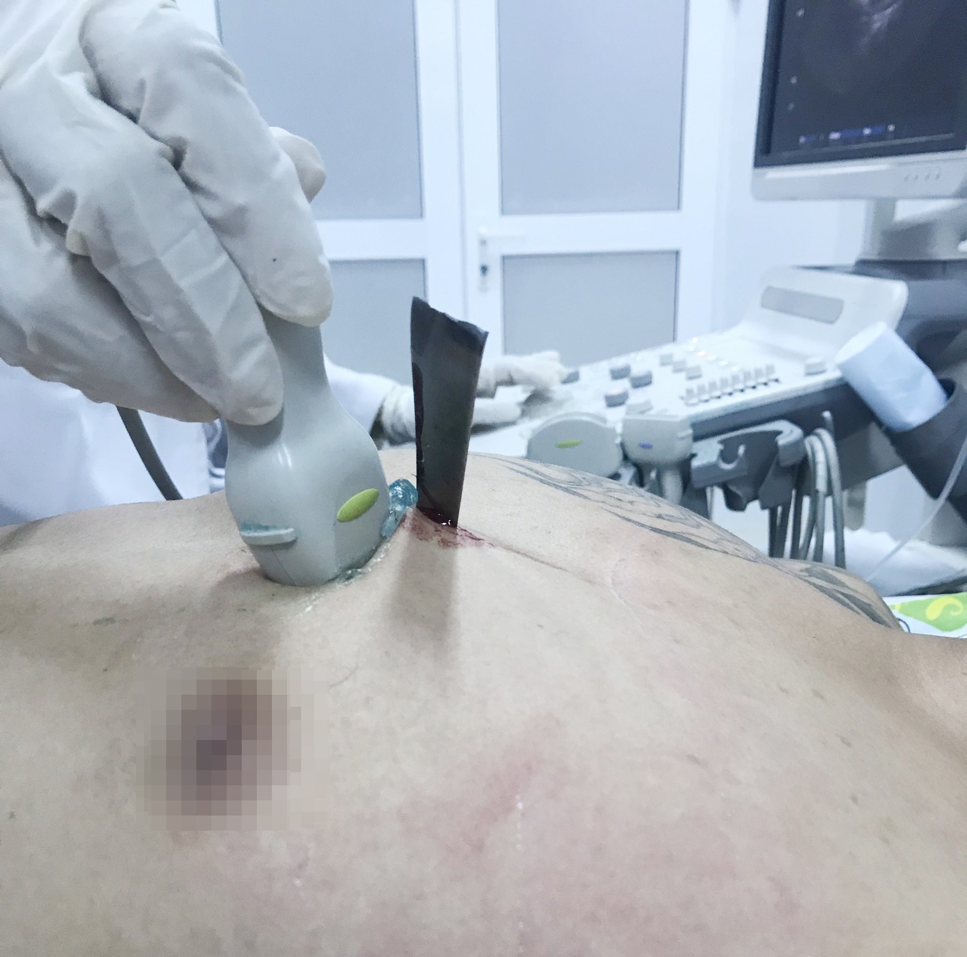 C&atilde;i v&atilde; với bạn g&aacute;i, thanh ni&ecirc;n tự đ&acirc;m thủng tim - Ảnh 1.